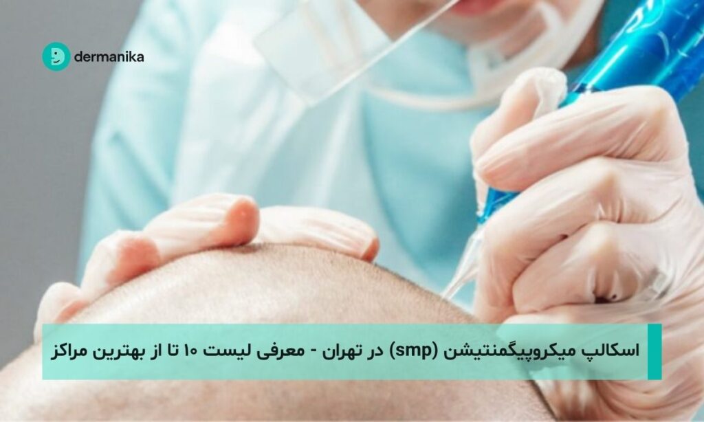 اسکالپ میکروپیگمنتیشن (smp) در تهران - لیست ۱۰ تا از بهترین مراکز
