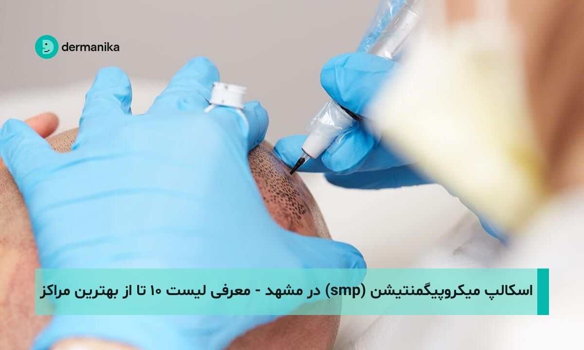 اسکالپ میکروپیگمنتیشن (smp) در مشهد - لیست ۱۰ تا از بهترین مراکز