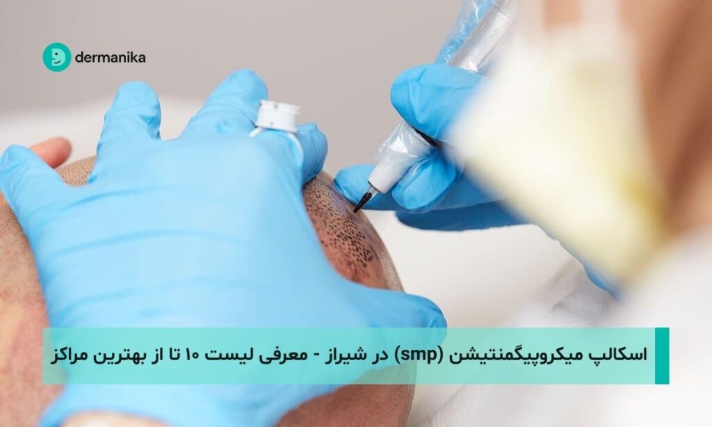 اسکالپ میکروپیگمنتیشن (smp) در شیراز - لیست ۱۰ تا از بهترین مراکز