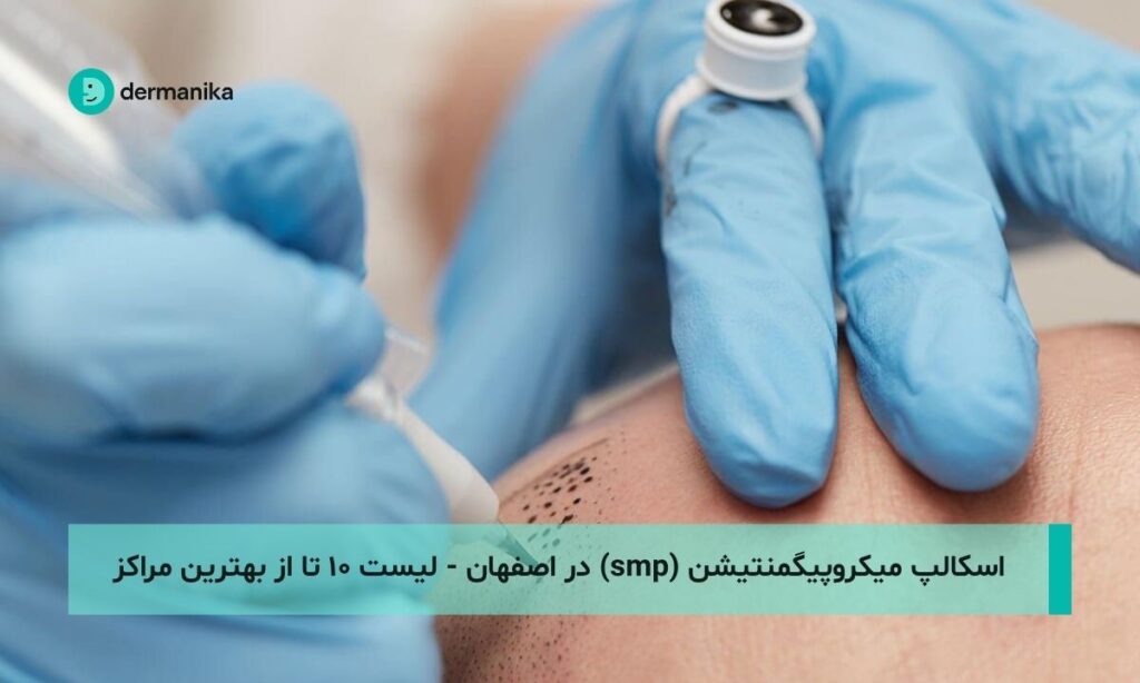 اسکالپ میکروپیگمنتیشن (smp) در اصفهان - لیست ۱۰ تا از بهترین مراکز