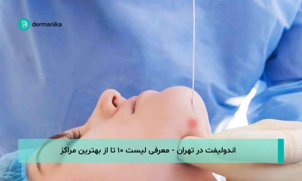 اندولیفت در تهران - معرفی لیست ۱۰ تا از بهترین مراکز