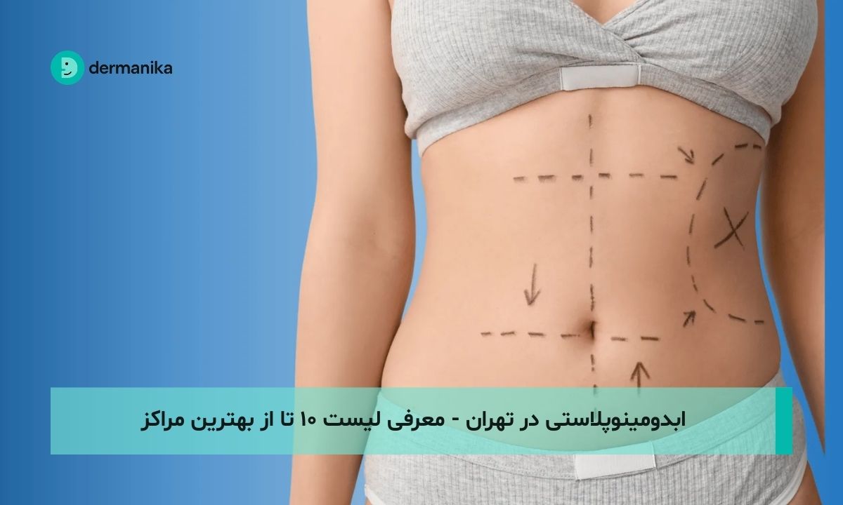 ابدومینوپلاستی در تهران - معرفی لیست ۱۰ تا از بهترین مراکز