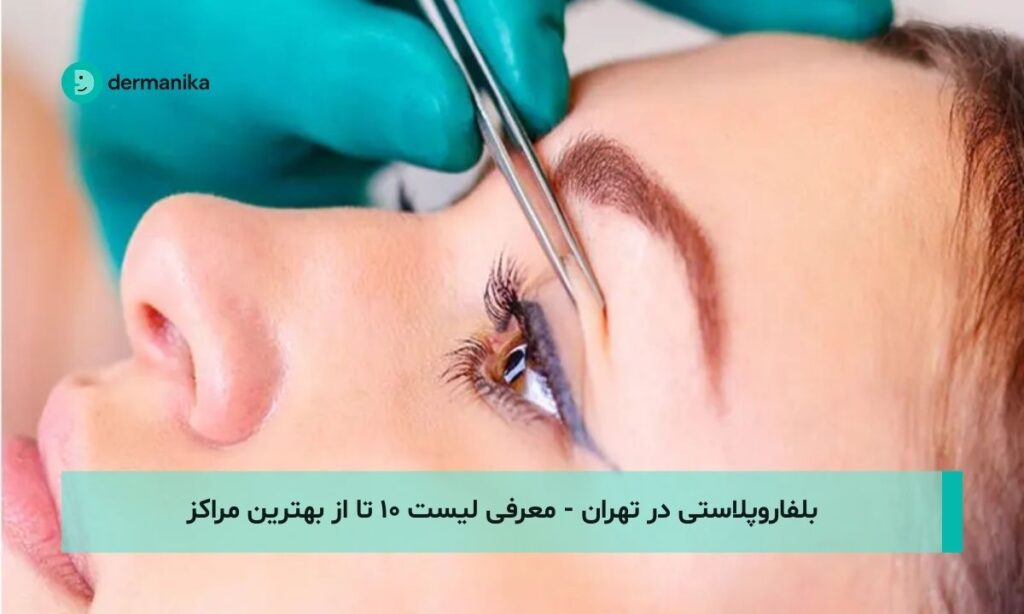 بلفاروپلاستی در تهران - معرفی لیست ۱۰ تا از بهترین مراکز