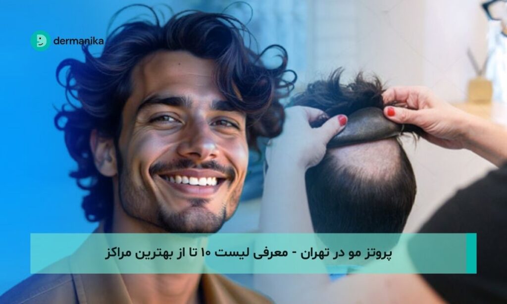 پروتز مو در تهران - معرفی لیست ۱۰ تا از بهترین مراکز