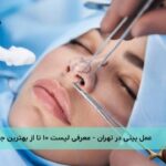 عمل بینی در تهران - معرفی لیست ۱۰ تا از بهترین جراحان