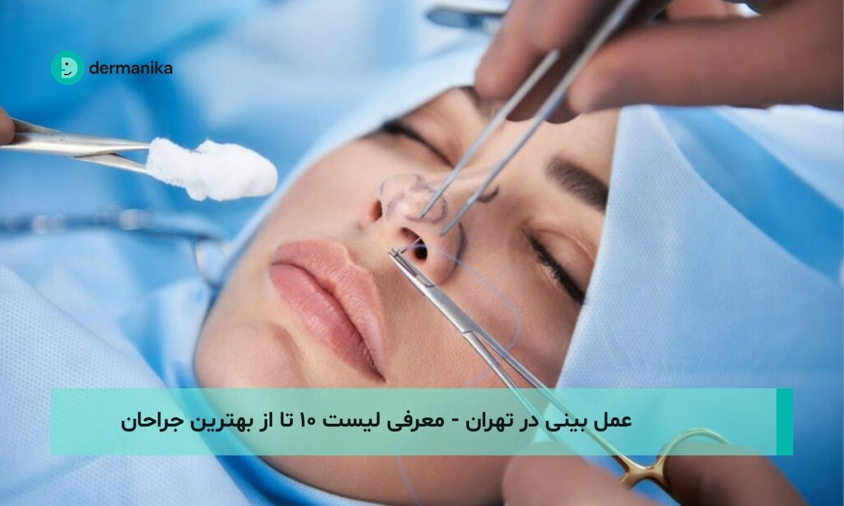 عمل بینی در تهران - معرفی لیست ۱۰ تا از بهترین جراحان