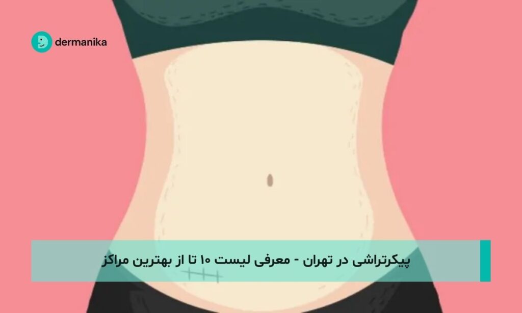 پیکرتراشی در تهران - معرفی لیست ۱۰ تا از بهترین مراکز