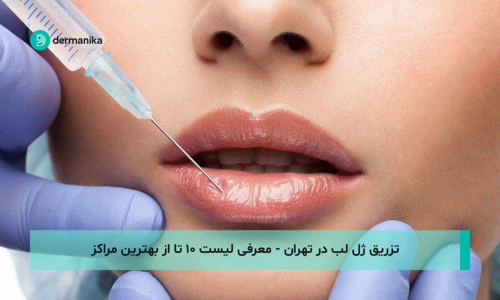 تزریق ژل لب در تهران - معرفی لیست ۱۰ تا از بهترین مراکز