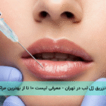 تزریق ژل لب در تهران - معرفی لیست ۱۰ تا از بهترین مراکز