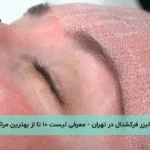 لیزر فرکشنال در تهران - معرفی لیست ۱۰ تا از بهترین مراکز