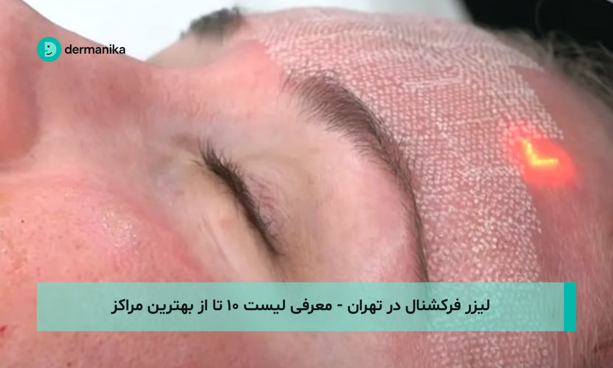 لیزر فرکشنال در تهران - معرفی لیست ۱۰ تا از بهترین مراکز