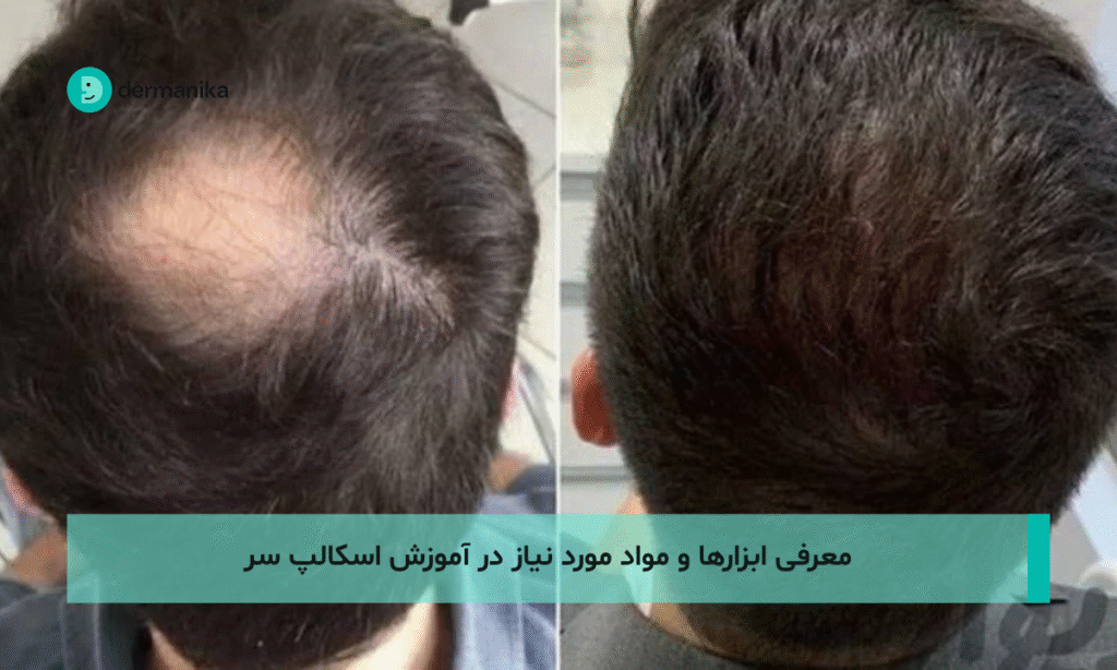 معرفی ابزارها و مواد مورد نیاز در آموزش اسکالپ سر