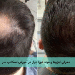 معرفی ابزارها و مواد مورد نیاز در آموزش اسکالپ سر