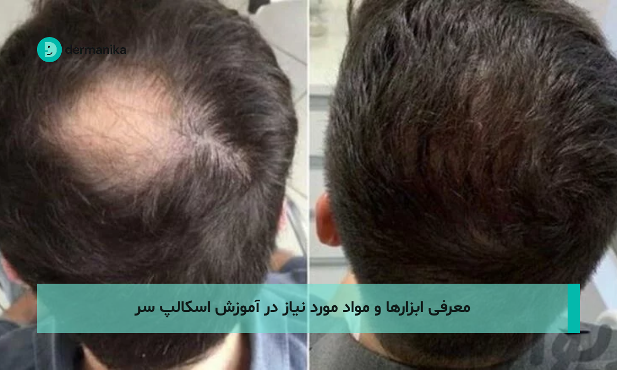 معرفی ابزارها و مواد مورد نیاز در آموزش اسکالپ سر