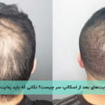 مراقبت‌های بعد از اسکالپ سر چیست؟ نکاتی که باید رعایت کنید