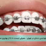 ارتودنسی دندان در تهران - معرفی لیست ۱۰ تا از بهترین مراکز