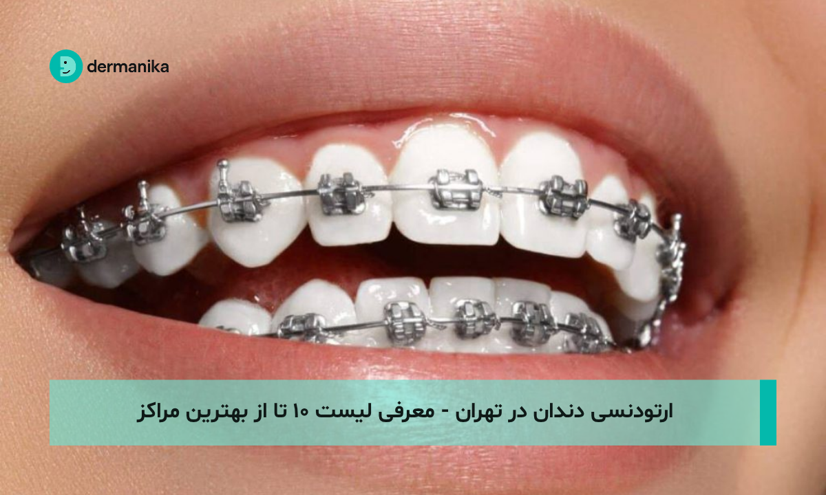 ارتودنسی دندان در تهران - معرفی لیست ۱۰ تا از بهترین مراکز