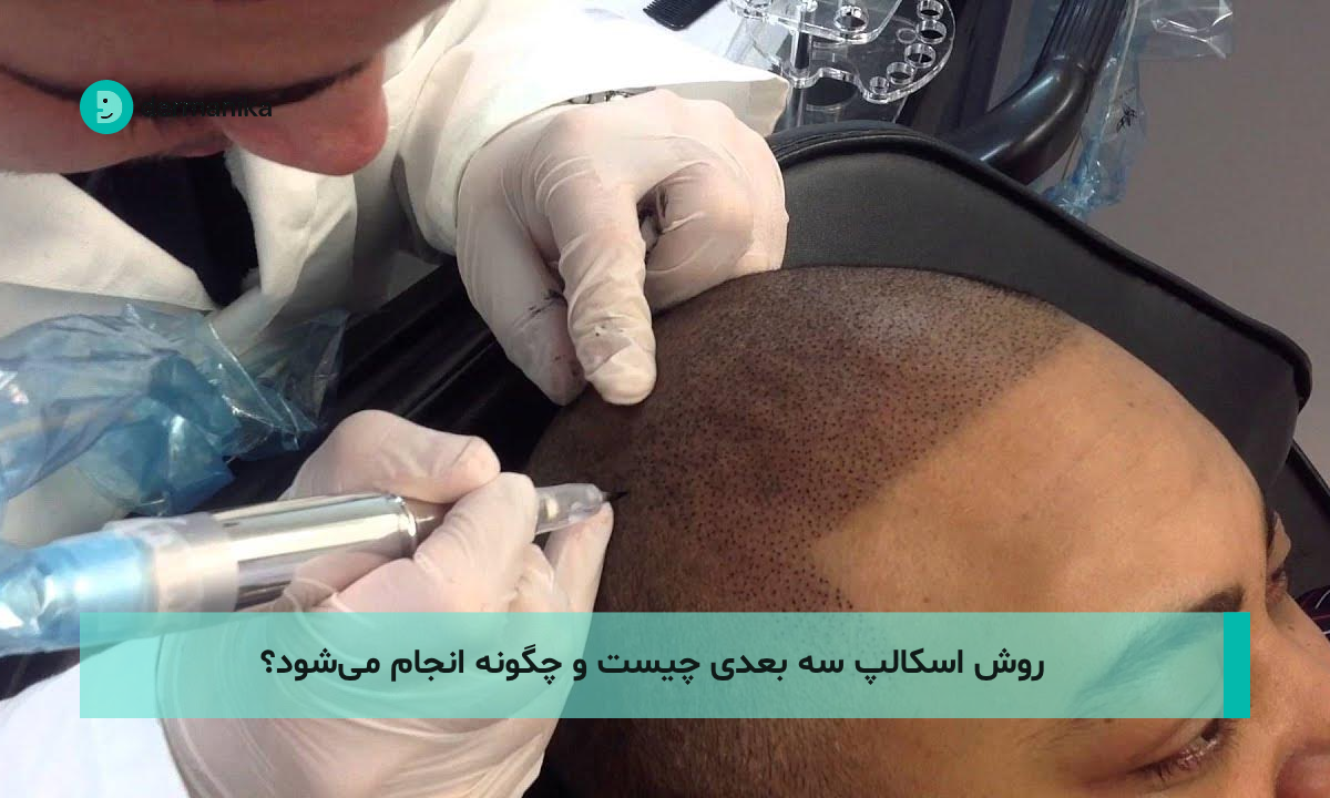 روش اسکالپ سه بعدی چیست و چگونه انجام می‌شود؟