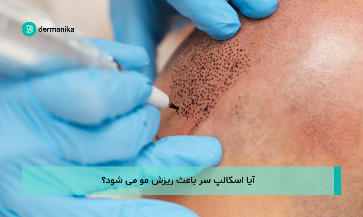 آیا اسکالپ سر باعث ریزش مو می شود؟
