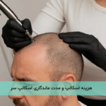 هزینه اسکالپ و مدت ماندگاری اسکالپ سر