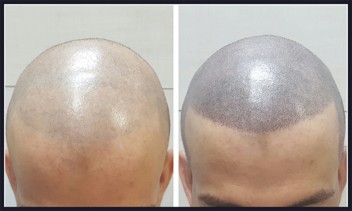 اسکالپ سه بعدی برای چه کسانی مناسب است؟