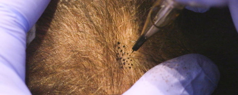 نحوه اجرای اسکالپ سه بعدی