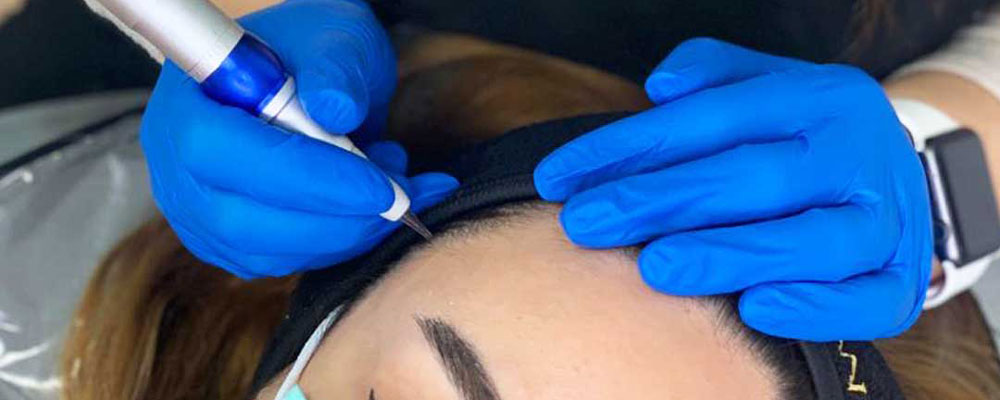 مراقبتهای بعد از اسکالپ سر