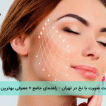 لیفت صورت با نخ در تهران - راهنمای جامع + معرفی بهترین دکتر