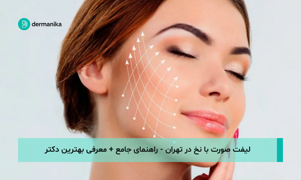 لیفت صورت با نخ در تهران - راهنمای جامع + معرفی بهترین دکتر