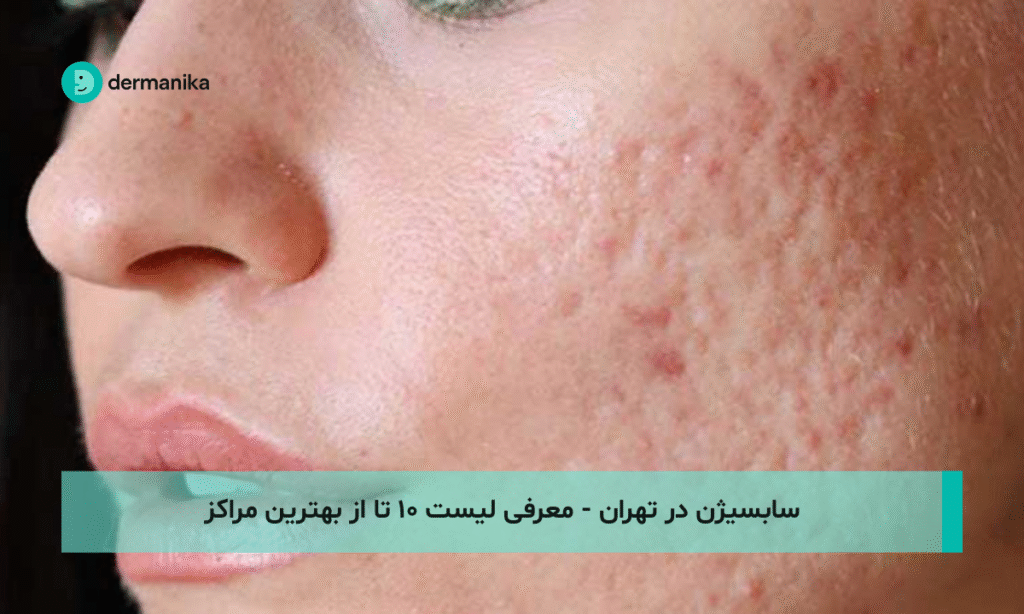 سابسیژن در تهران - معرفی لیست ۱۰ تا از بهترین مراکز