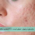 سابسیژن در تهران - معرفی لیست ۱۰ تا از بهترین مراکز