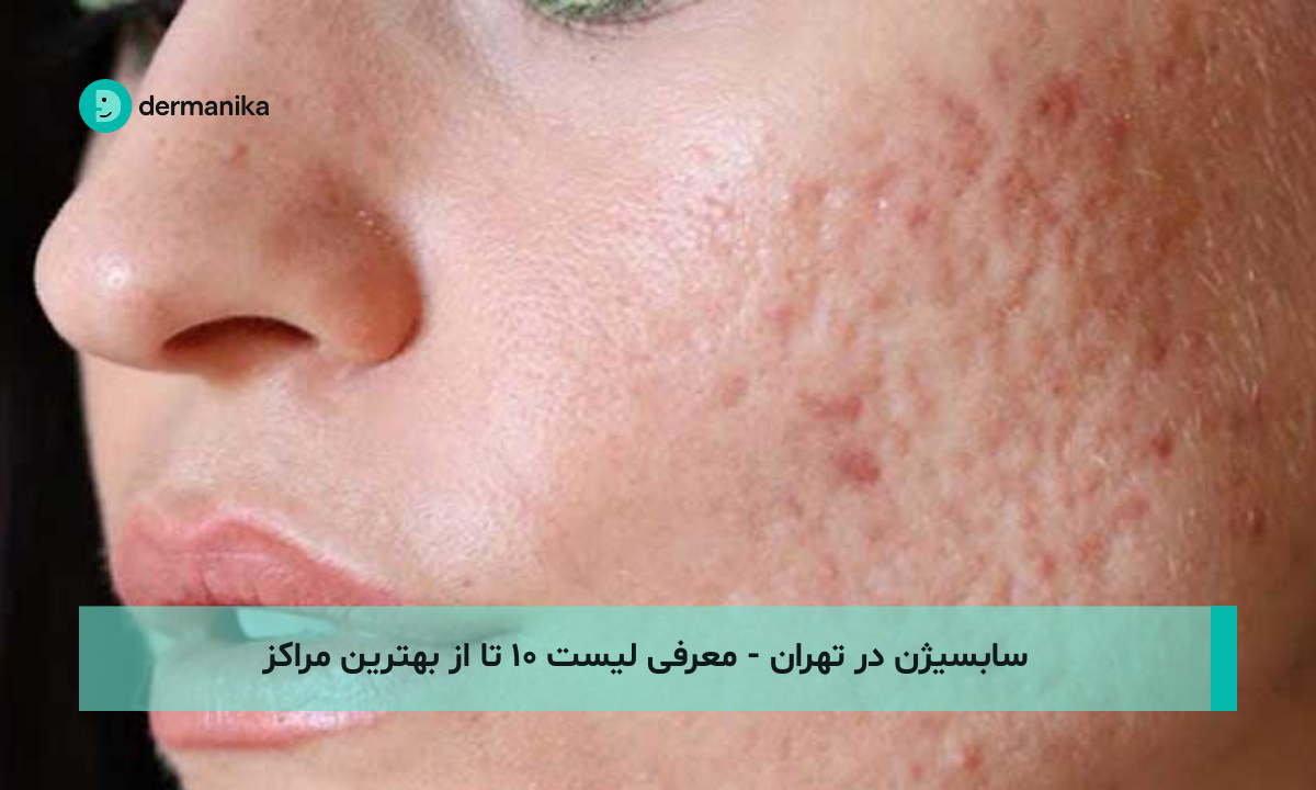 سابسیژن در تهران - معرفی لیست ۱۰ تا از بهترین مراکز