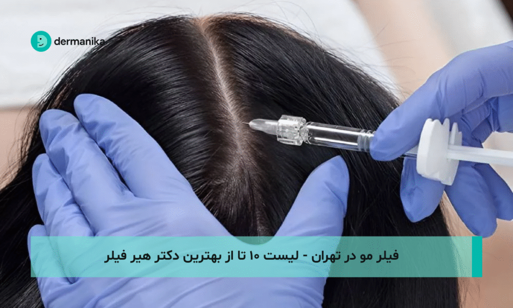 فیلر مو در تهران - لیست ۱۰ تا از بهترین دکتر هیر فیلر