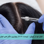 فیلر مو در تهران - لیست ۱۰ تا از بهترین دکتر هیر فیلر