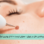 برداشتن خال در تهران - معرفی لیست ۱۰ تا از بهترین مراکز