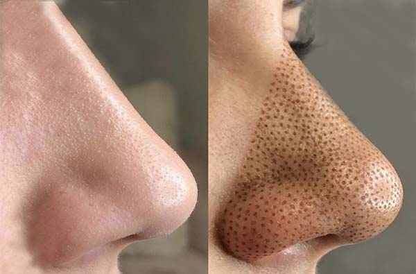 بهترین مرکز پلاسما بینی در تهران + تلفن و آدرس