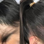 لیست 10 تا از بهترین مرکز اسکالپ سر در کرج + تلفن و آدرس