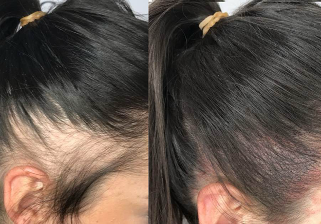 لیست 10 تا از بهترین مرکز اسکالپ سر در کرج + تلفن و آدرس